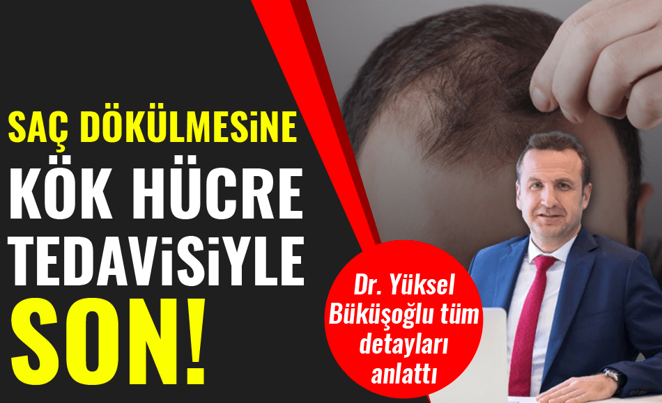 Saç Dökülmesine Kök Hücre Tedavisi ile Son!