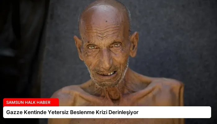 Gazze Kentinde Yetersiz Beslenme Krizi Derinleşiyor